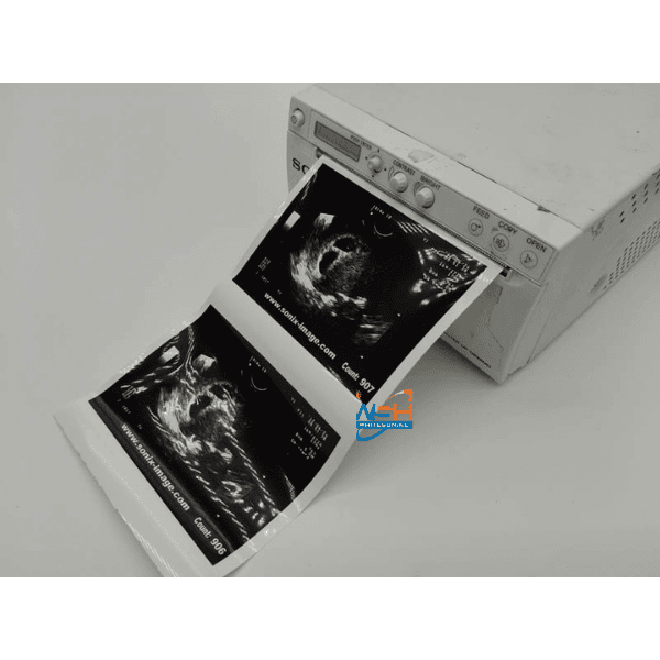 Ultrasound Paper Rolls UPP-110HD Thumbnail 2